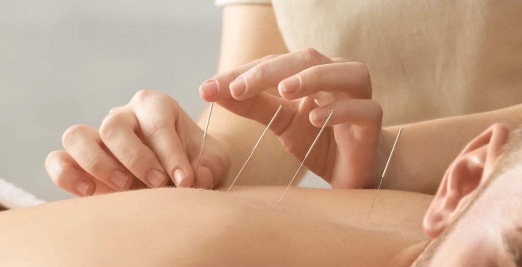 AcupunctureFB